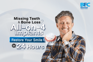 All-on-4 Implants