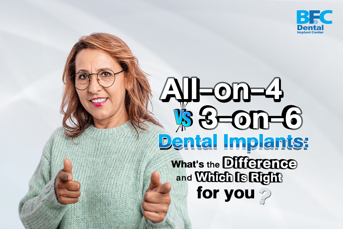 3-on-6 Dental Implants