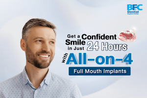 All-on-4 Full Mouth Implants