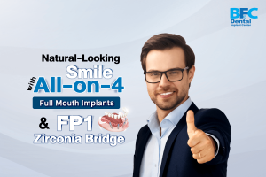 All-on-4 Full Mouth Implants