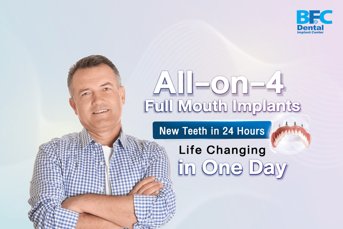 All-on-4 Full Mouth Implants