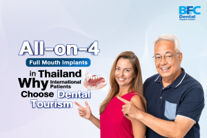 All-on-4 Full Mouth Implants in Thailand