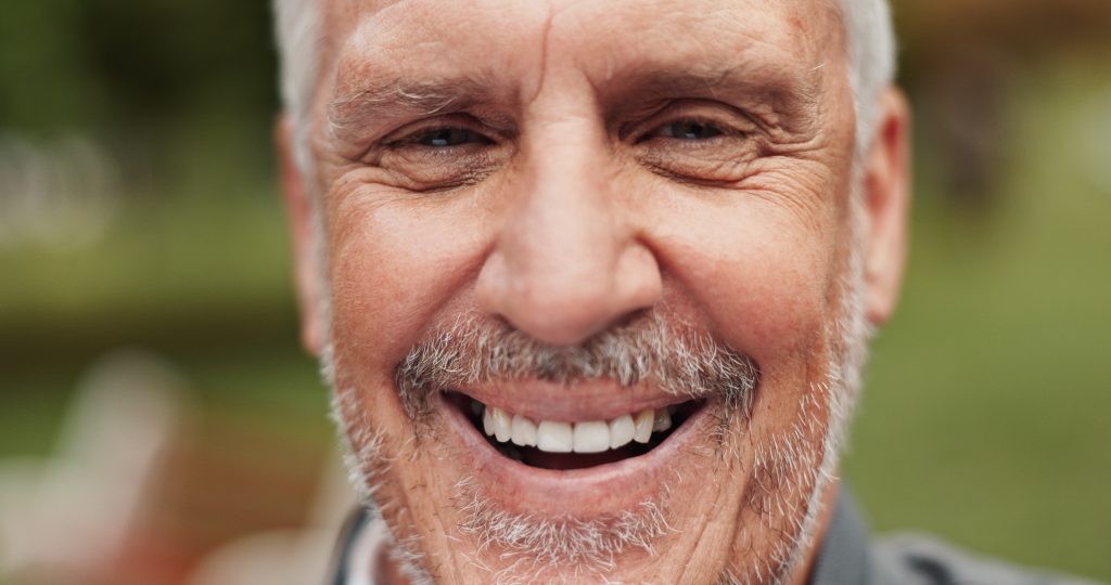 All-on-4 Full Mouth Implants in Thailand