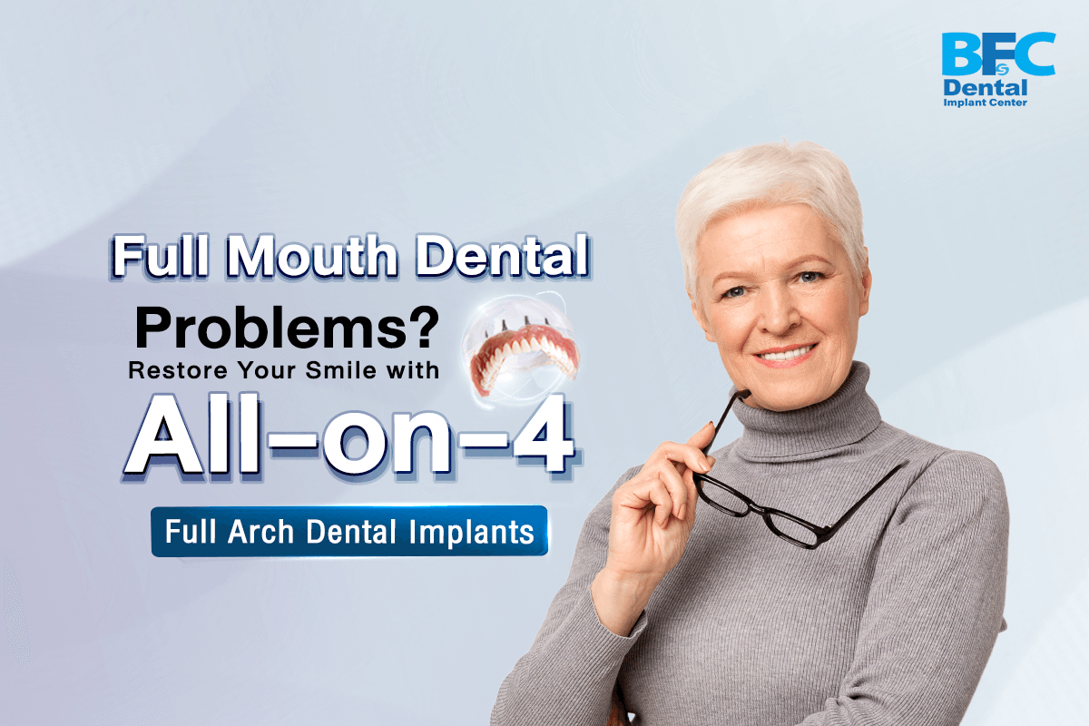 All-on-4 Full Arch Dental Implants