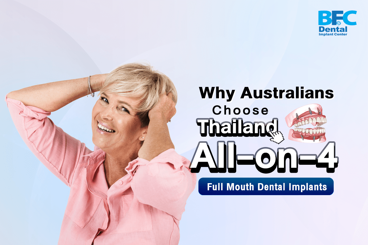 All-on-4 Full Mouth Dental Implants