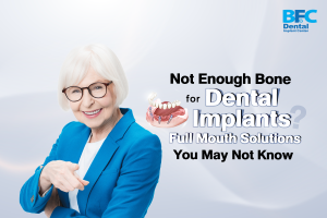 Full Mouth Dental Implants