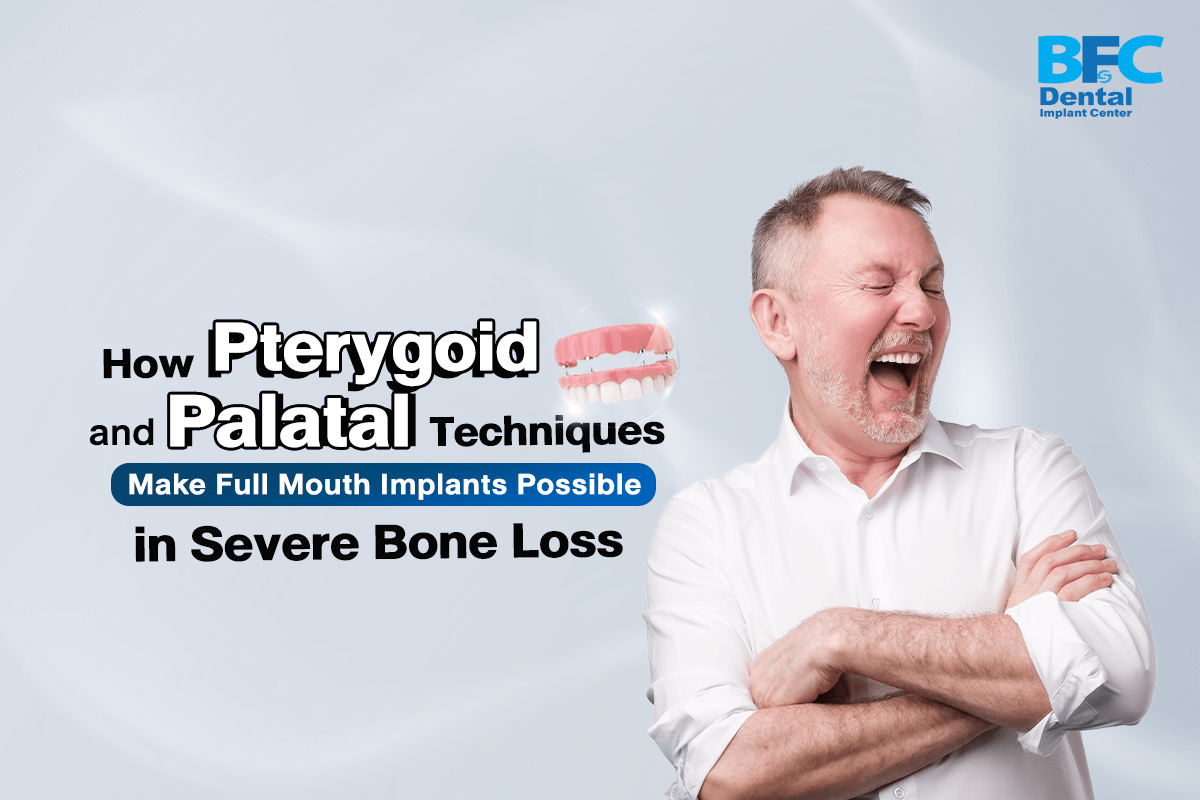 Pterygoid and Palatal Techniques