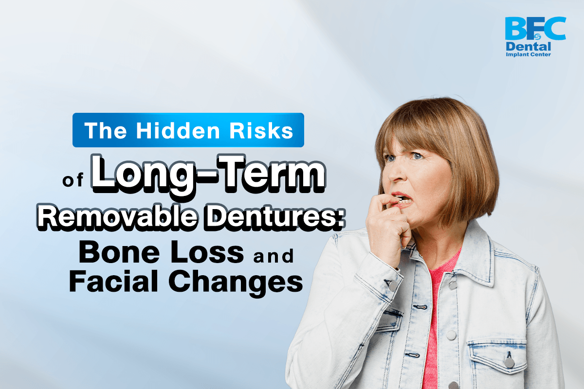 Long-Term Removable Dentures