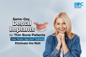 Palatal Approach Implants