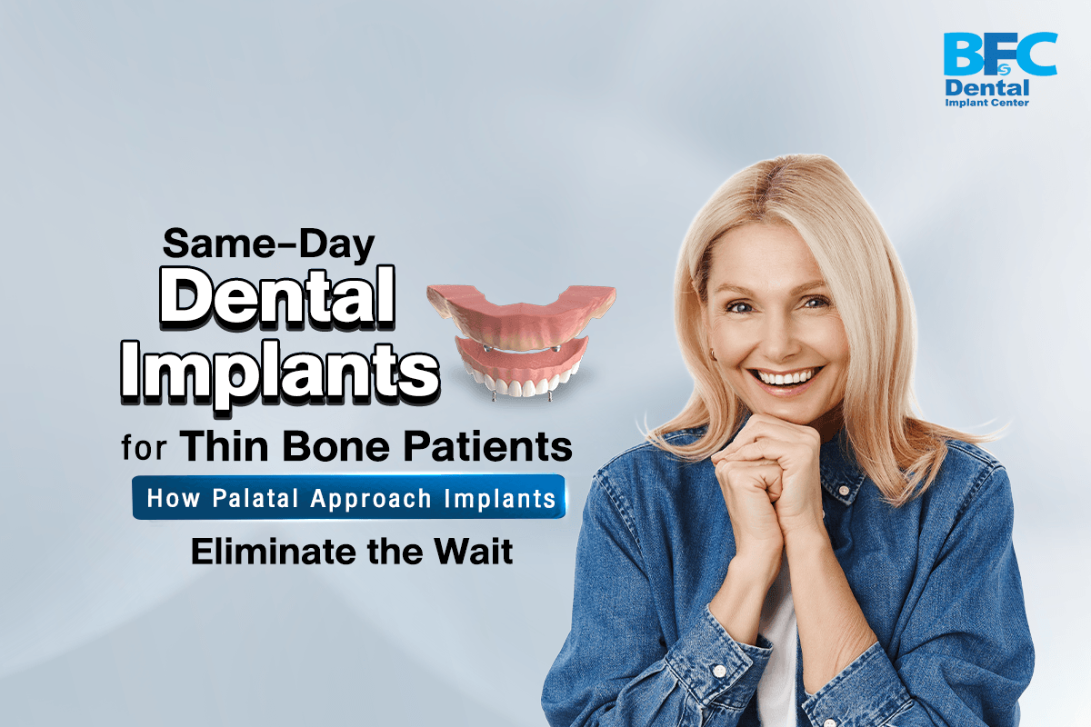 Palatal Approach Implants