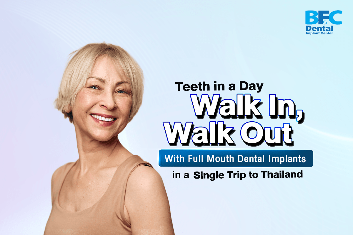 Full Mouth Dental Implants