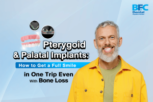 Pterygoid & Palatal Implants