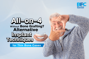 Implant Techniques