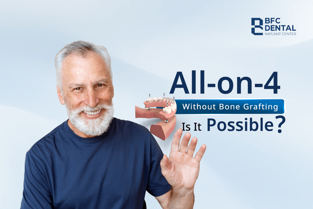 All-on-4