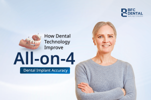 All-on-4 Dental Implant Accuracy