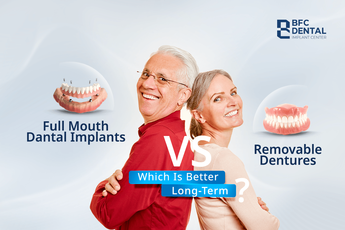 Full Mouth Dental Implants vs Removable Dentures