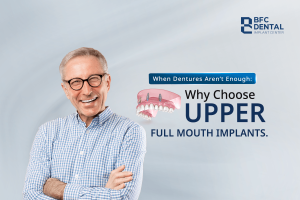 Upper Full Mouth Implants